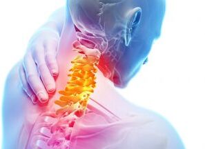 Schmerz und Unterkünfte in der Gebärmutterhalszone mit dem dritten Grad der Osteochondrose